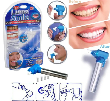 Відбілювач зубів Luma Smile Набір для відбілювання зубів, Блакитний